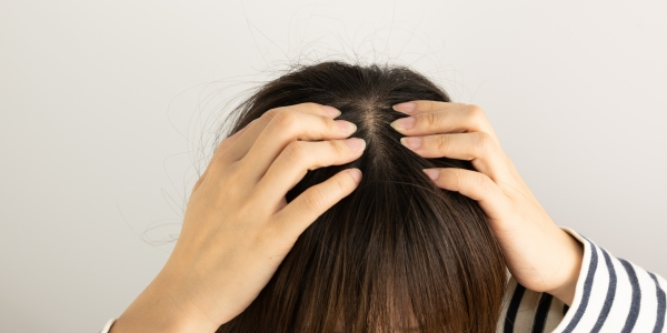 女性の薄毛におけるミノキシジルの治療方法・副作用について