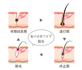 乱れたヘアサイクル